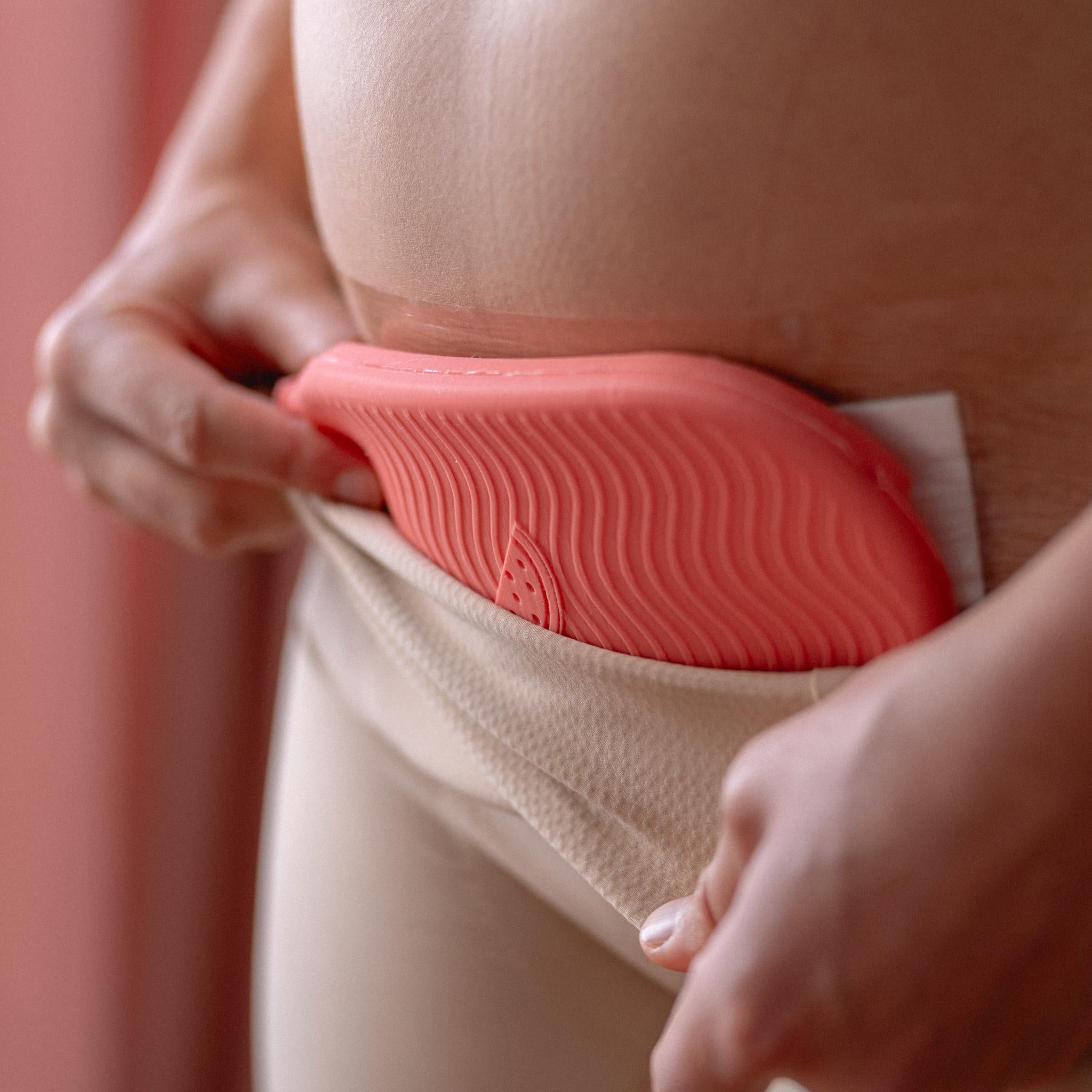 What New Moms Need to Know About C-Section Recovery